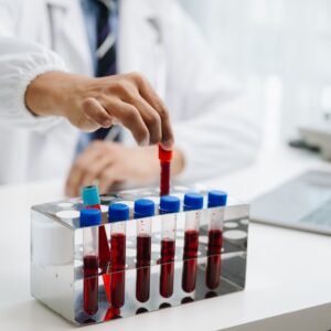 Lymphozyten: Funktionen, Arten und Blutwerte