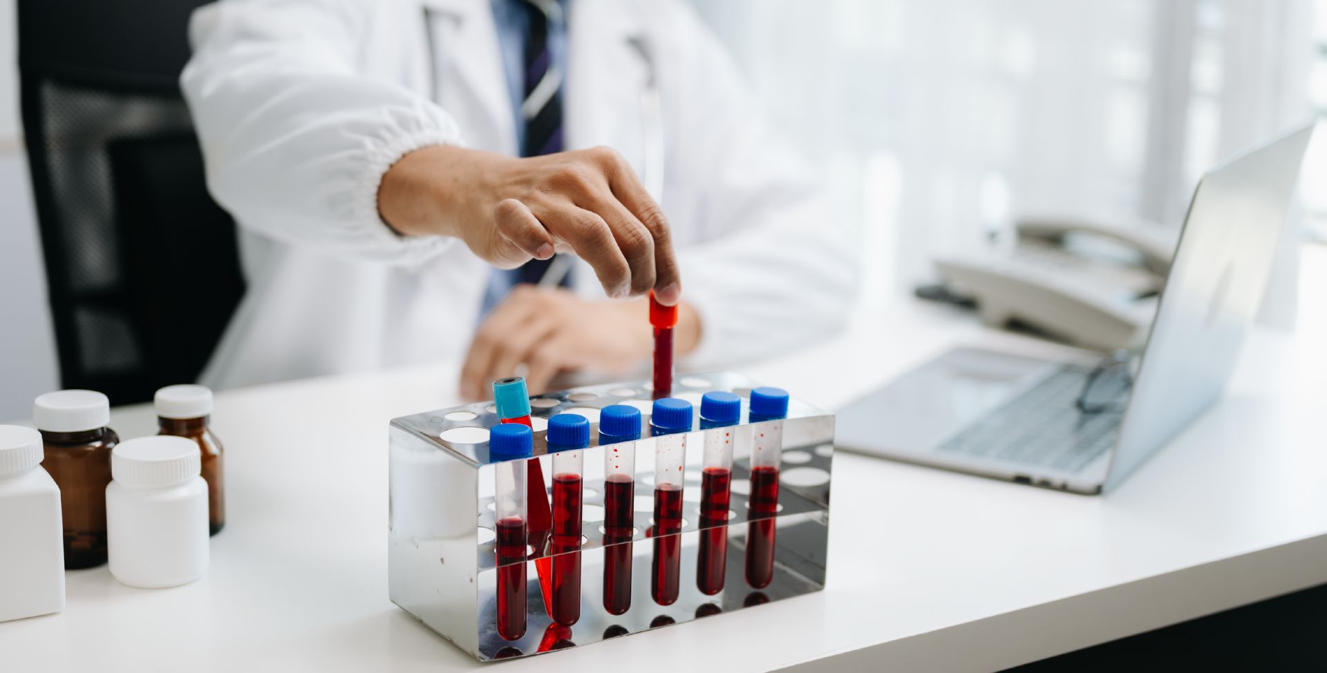 Ein Labormitarbeiter mit Blutproben zur Messung der Lymphozyten.