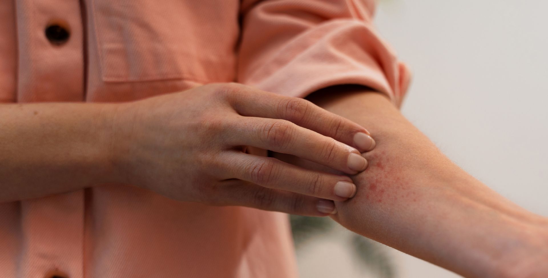 Eine Person kratzt ihren Arm mit Ekzem.