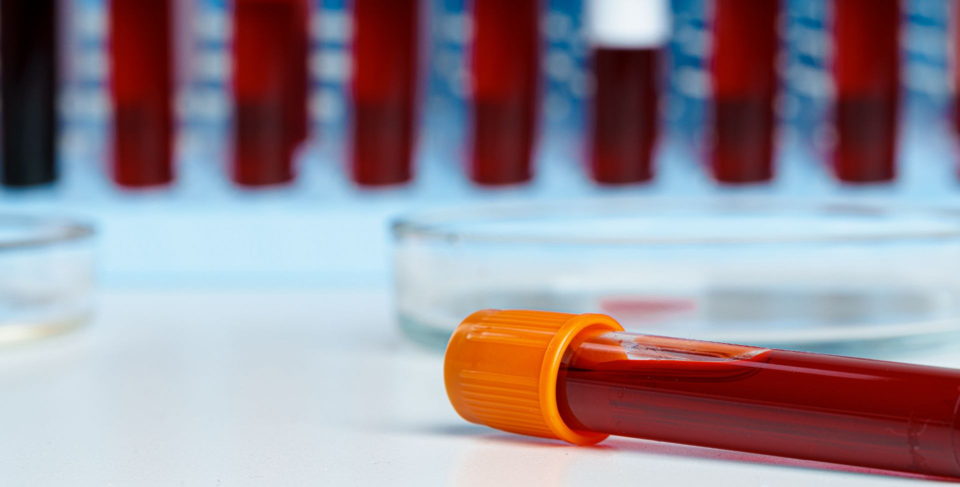 Reagenzgläser mit Blut im Labor, die jeweils eine andere Blutgruppe enthalten.