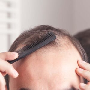 Was sind Gründe für Haarausfall? Ursachen, Symptome und Behandlung